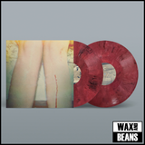 LOS CAMPESINOS! - We Are Beautiful, We Are Doomed (2026 Reissue) (2LP 'Bruise So Black' Marble Vinyl)