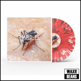 Hard-Fi - Sweating Someone Else's Fever (Red, White & Black Splatter Vinyl)